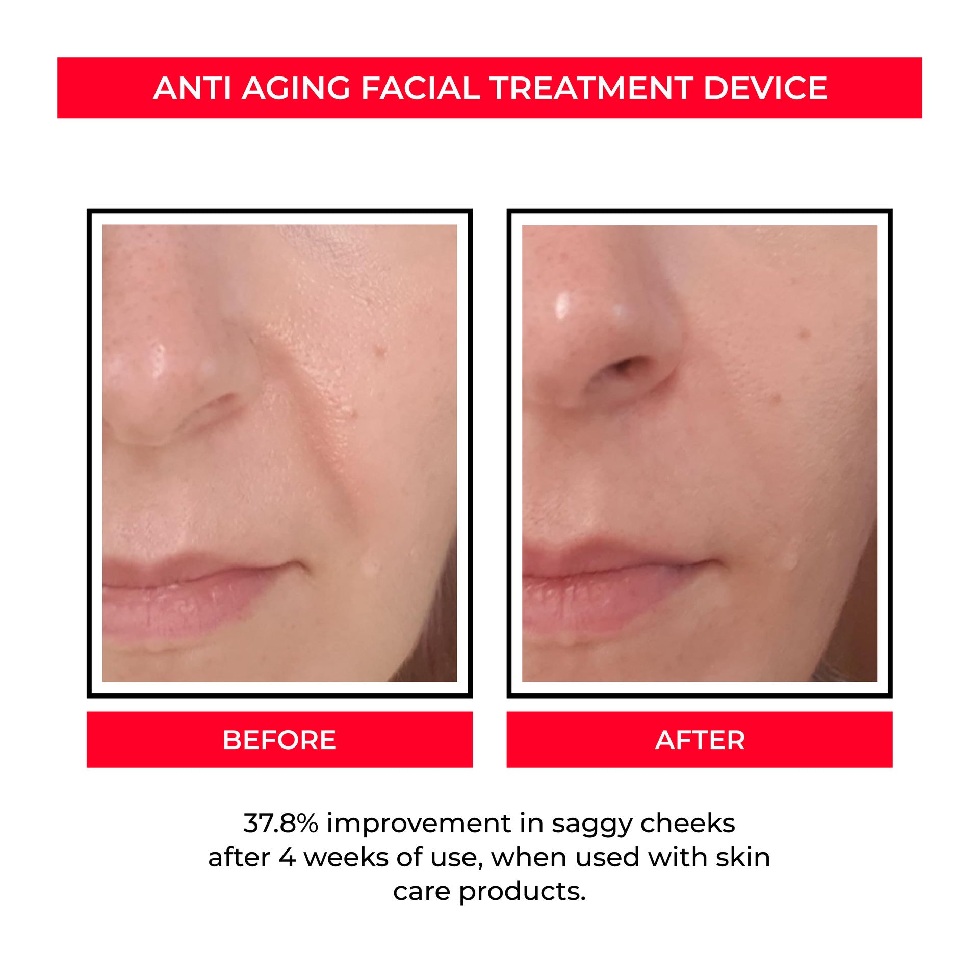EMS Skin Rejuvenation Micro Current